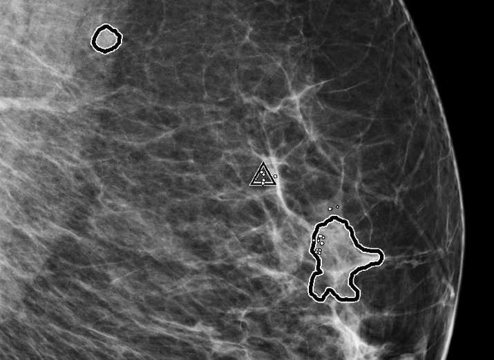 Hologic ImageChecker™ 2D CAD Technology