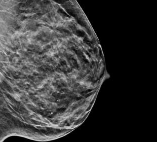 Hologic C-View™ Synthesised 2D Imaging in white background