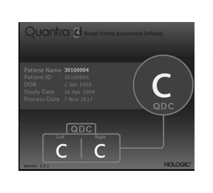 Hologic Quantra™ Technology in white background